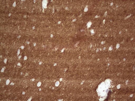 Monoclonal Mouse anti-Human NCAM / CD56 Antibody (clone OTI1B9, aa20-718, IHC, WB)