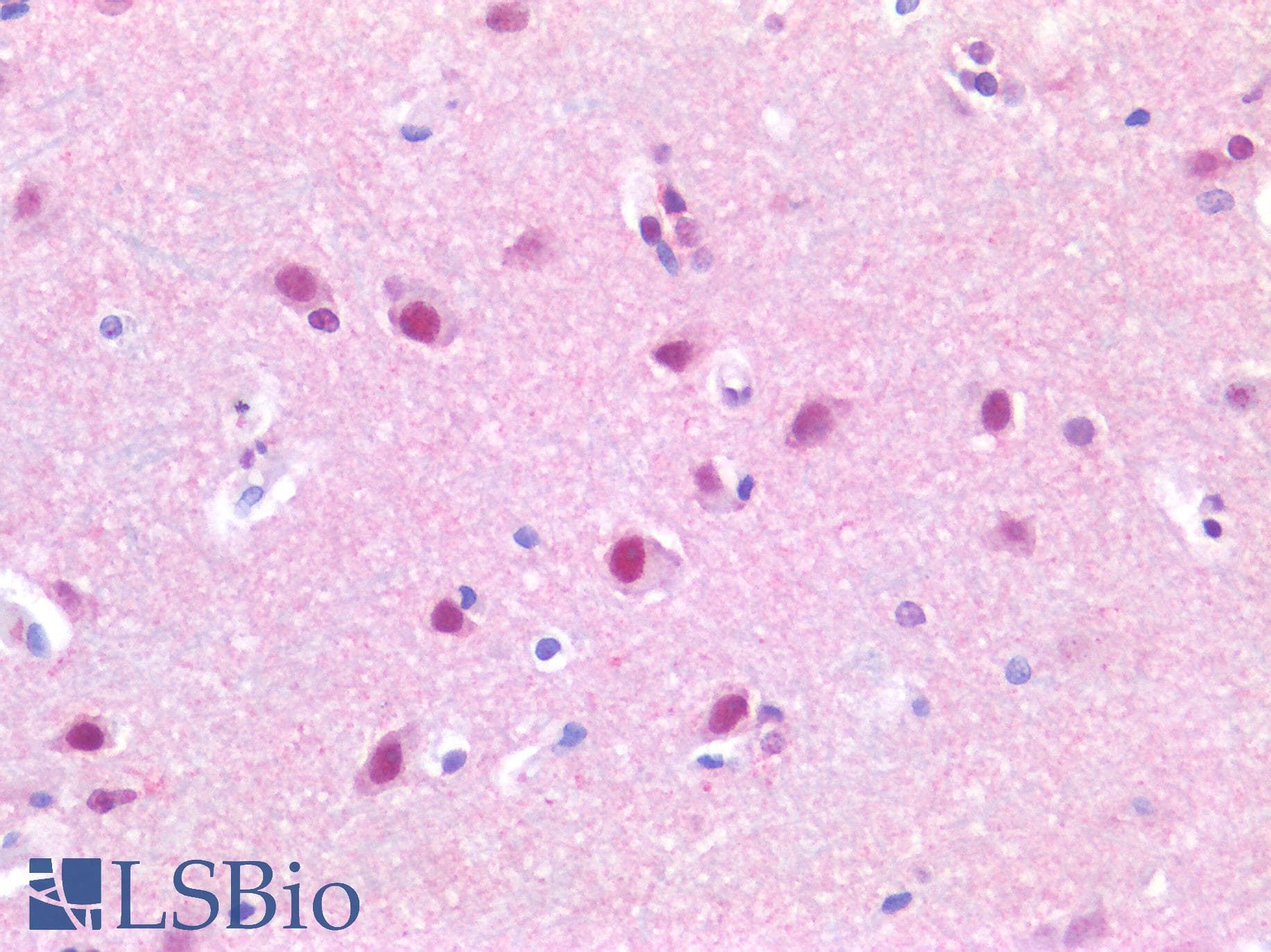 IHC-plus™ SUV420H1 Antibody (Preservative Free)
