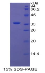 Human WNT3 Protein (Recombinant His-T7)
