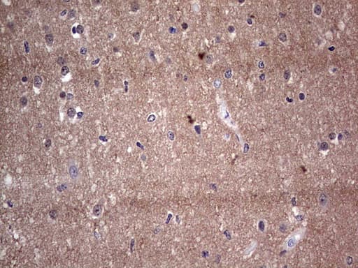 Adiponectin Antibody (aa19-244, clone OTI8A9)