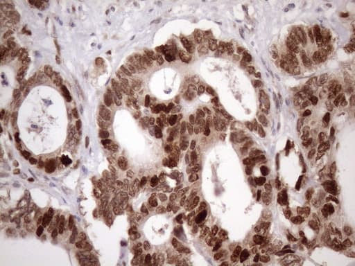 Monoclonal Mouse anti-Human BTEB / KLF9 Antibody (clone OTI8A11, IHC, WB)