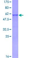 Human HDAC7 Protein (Recombinant GST)