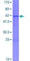 Human ASCL1 / MASH1 Protein (Recombinant GST)