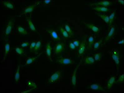 Polyclonal Rabbit anti-Human EYA1 Antibody (IF)
