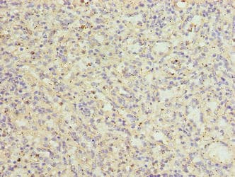 CATSPER2 Antibody