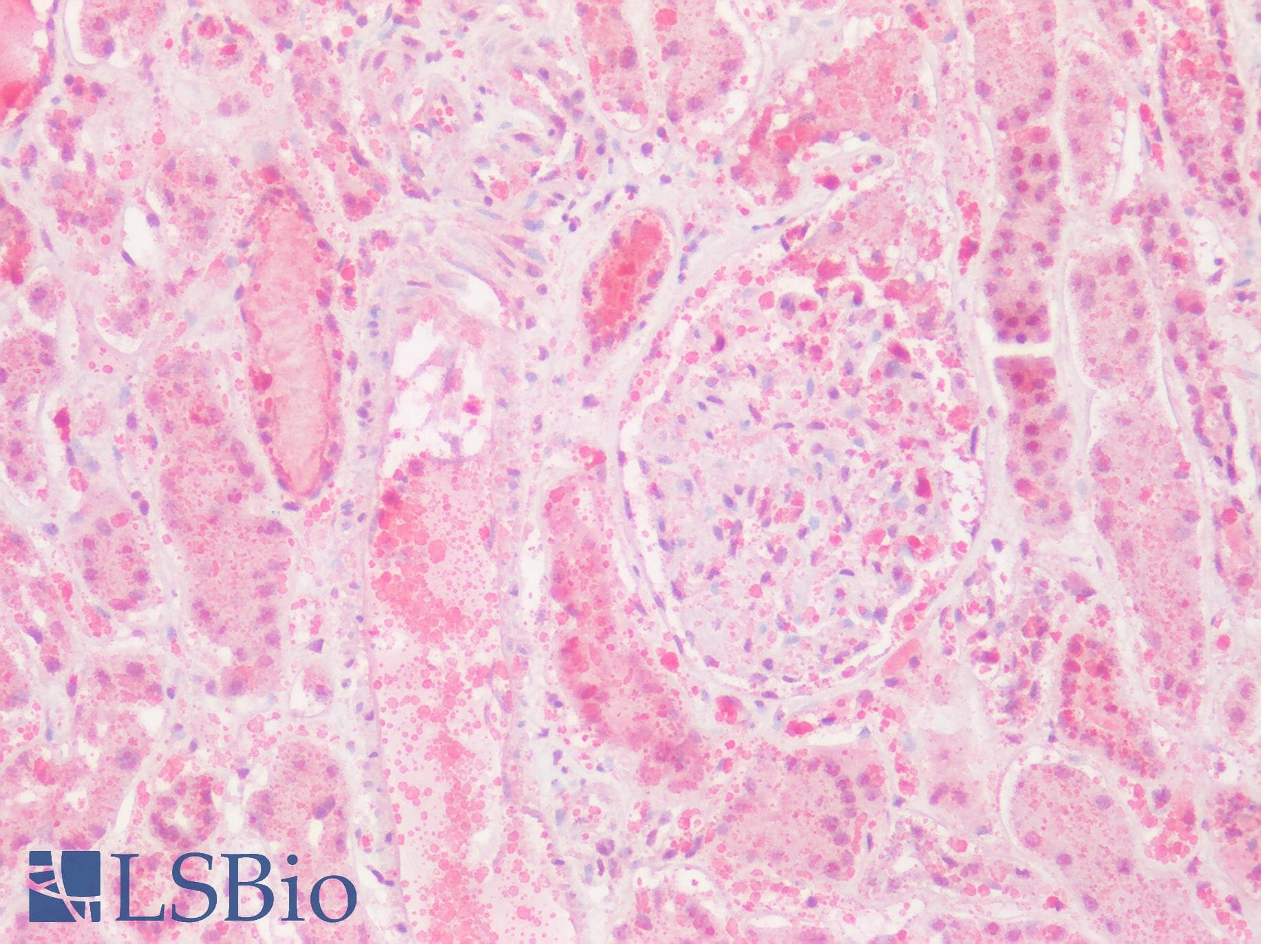PathPlus™ GPRC5D Antibody (N-Terminus)