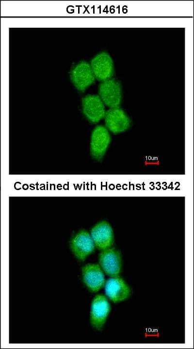 HNRNP-E2 / PCBP2 Antibody (aa1-193)