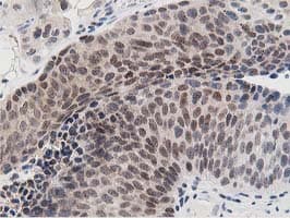 Dipeptidyl Peptidase 3 / DPP3 Antibody (clone OTI2D9)