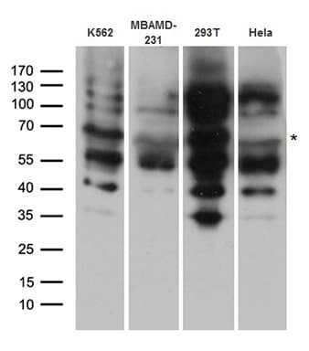 EPOR / EPO Receptor Antibody