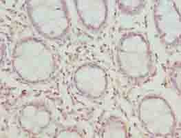 Polyclonal Rabbit anti-Human CLYBL Antibody (IHC, WB)