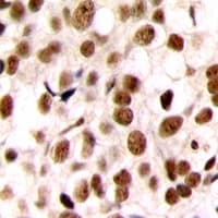 CEBPZ / CBF Antibody (N-Terminus)