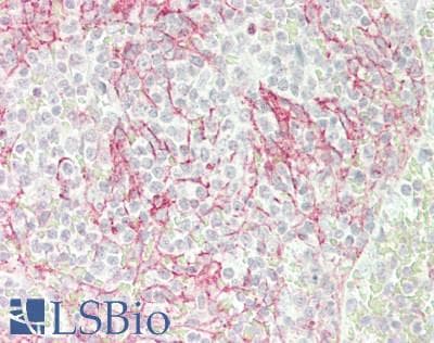 IHC-plus™ FZD1 / Frizzled 1 Antibody (aa6-55)