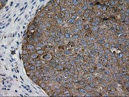 Monoclonal Mouse anti-Human MAC-2-BP / LGALS3BP Antibody (clone OTI6B7, IHC, WB)