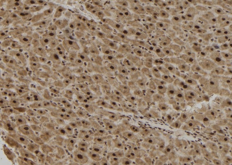 Polyclonal Rabbit anti-Human TCF19 / TCF-19 Antibody (IHC, IF, WB)