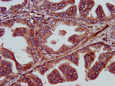 Polyclonal Rabbit anti-Human GINS1 / PSF1 Antibody (IHC)