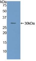 Rat F3 / CD142 / Tissue factor Protein (Recombinant His, N-Terminal)