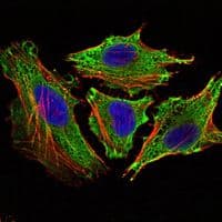 STAT6 Antibody (clone 7D3)