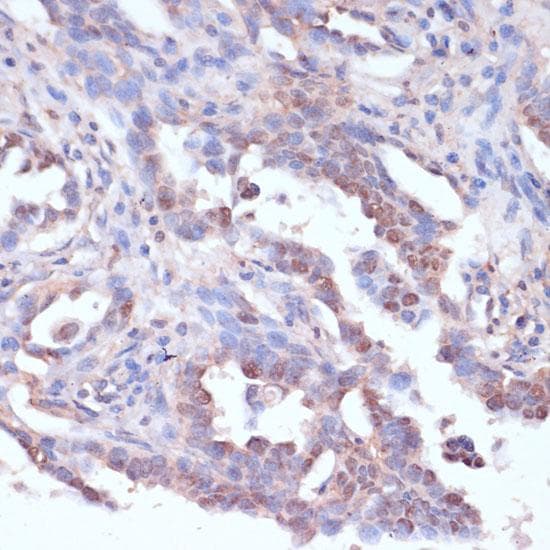 CARTPT / CART Antibody