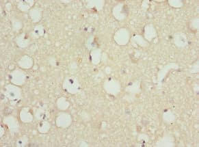 PITRM1 / MP1 Antibody