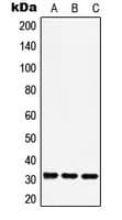 RAD1 Antibody (Internal)