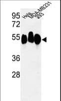 RBBP7 / RbAp46 Antibody (aa1-30)