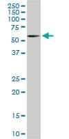 RICK / RIP2 Antibody (clone 6F7)
