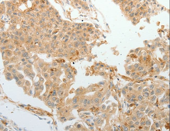 ASCL1 / MASH1 Antibody