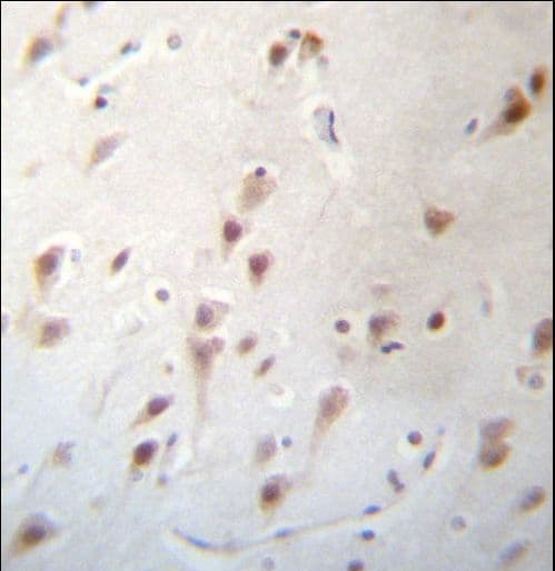 FOXJ3 Antibody (aa148-176)