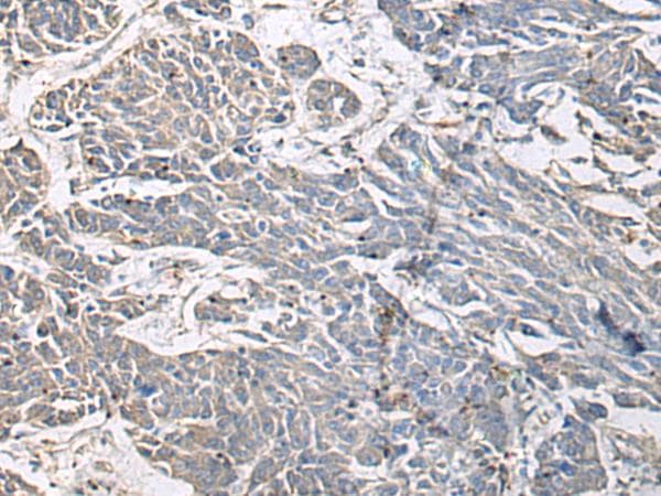 Polyclonal Rabbit anti-Human PRKCSH Antibody (IHC)