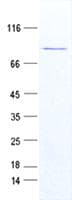 Human MYCN / N-myc Protein (Recombinant GST, N-terminus + His, C-terminus)