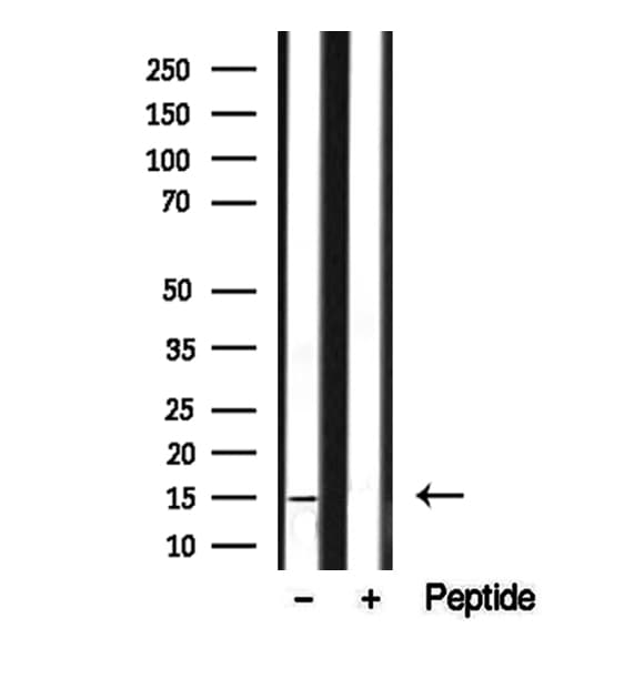 SNAPIN Antibody