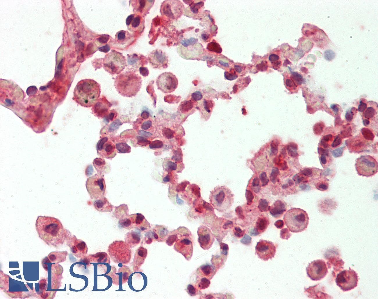 IHC-plus™ CXCL10 / IP-10 Antibody (aa22-98)