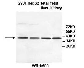Polyclonal Rabbit anti-Human DDH / AKR1C1 Antibody (aa2-218, IHC, WB)