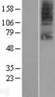 SLC22A9 / OAT7 Protein (Over-Expression Lysate Myc-DDK (Flag))