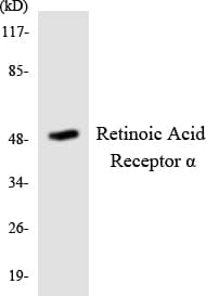 RARA / RAR Alpha Antibody (aa22-71)