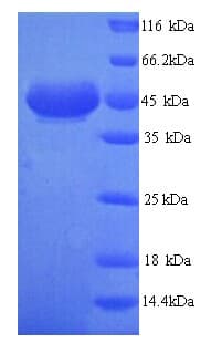 Human ADH7 Protein (Recombinant His)