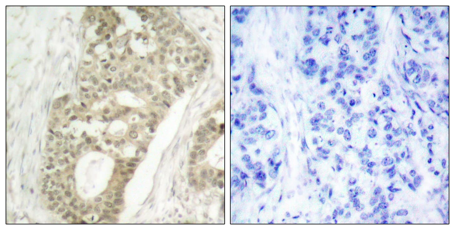 Polyclonal Rabbit anti-Human PRKCD / PKC-Delta Antibody (phospho-Ser645, IHC, WB)