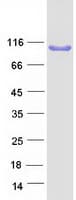 Human ASAP3 Protein (Recombinant Myc-DDK (Flag))