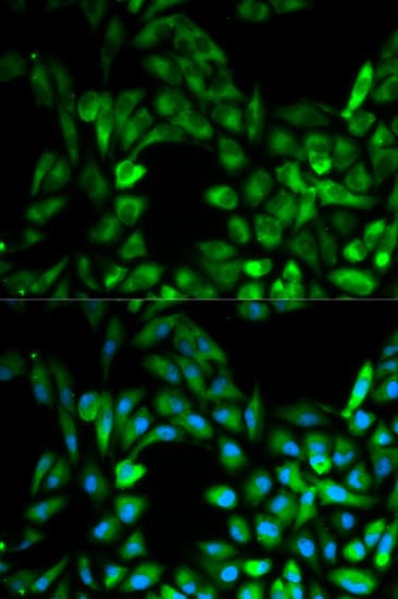 IKBKG / NEMO / IKK Gamma Antibody