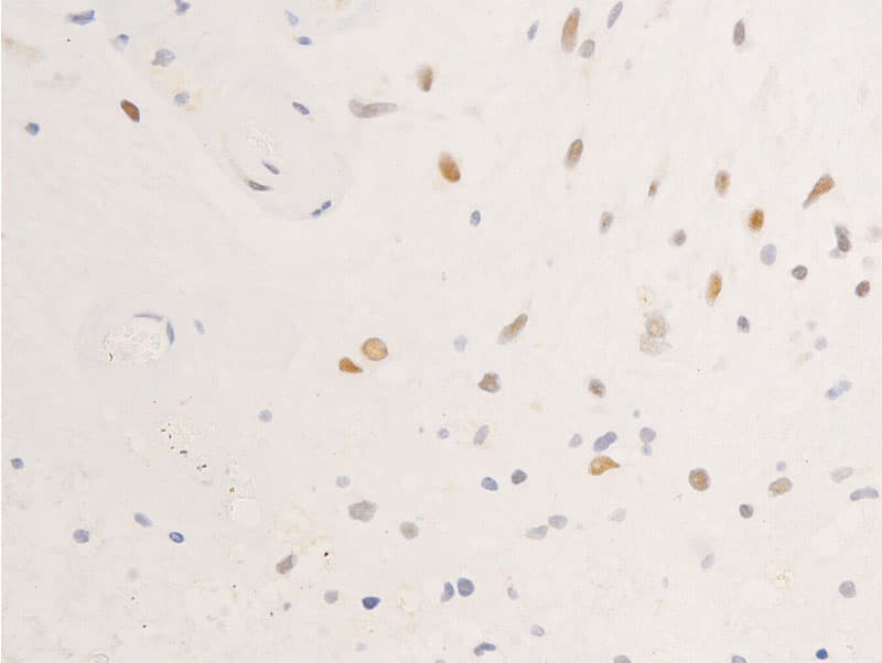 EGFR Antibody (phospho-Ser695)