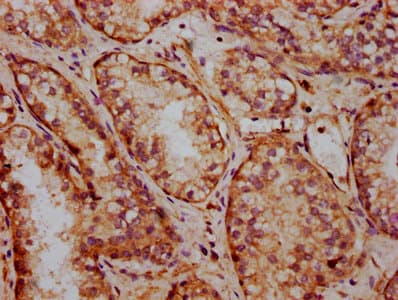 Polyclonal Rabbit anti-Human FRMD7 Antibody (IHC, WB)
