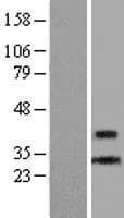 CENPL Protein (Over-Expression Lysate Myc-DDK (Flag))