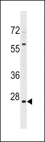 NSBP1 / HMGN5 Antibody (aa60-86)
