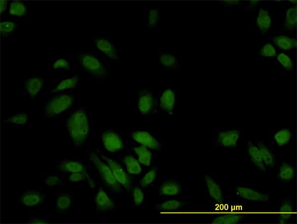 PathPlus™ S100A6 / Calcyclin Antibody (clone 6B5)