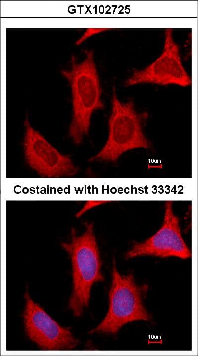 PPAT Antibody