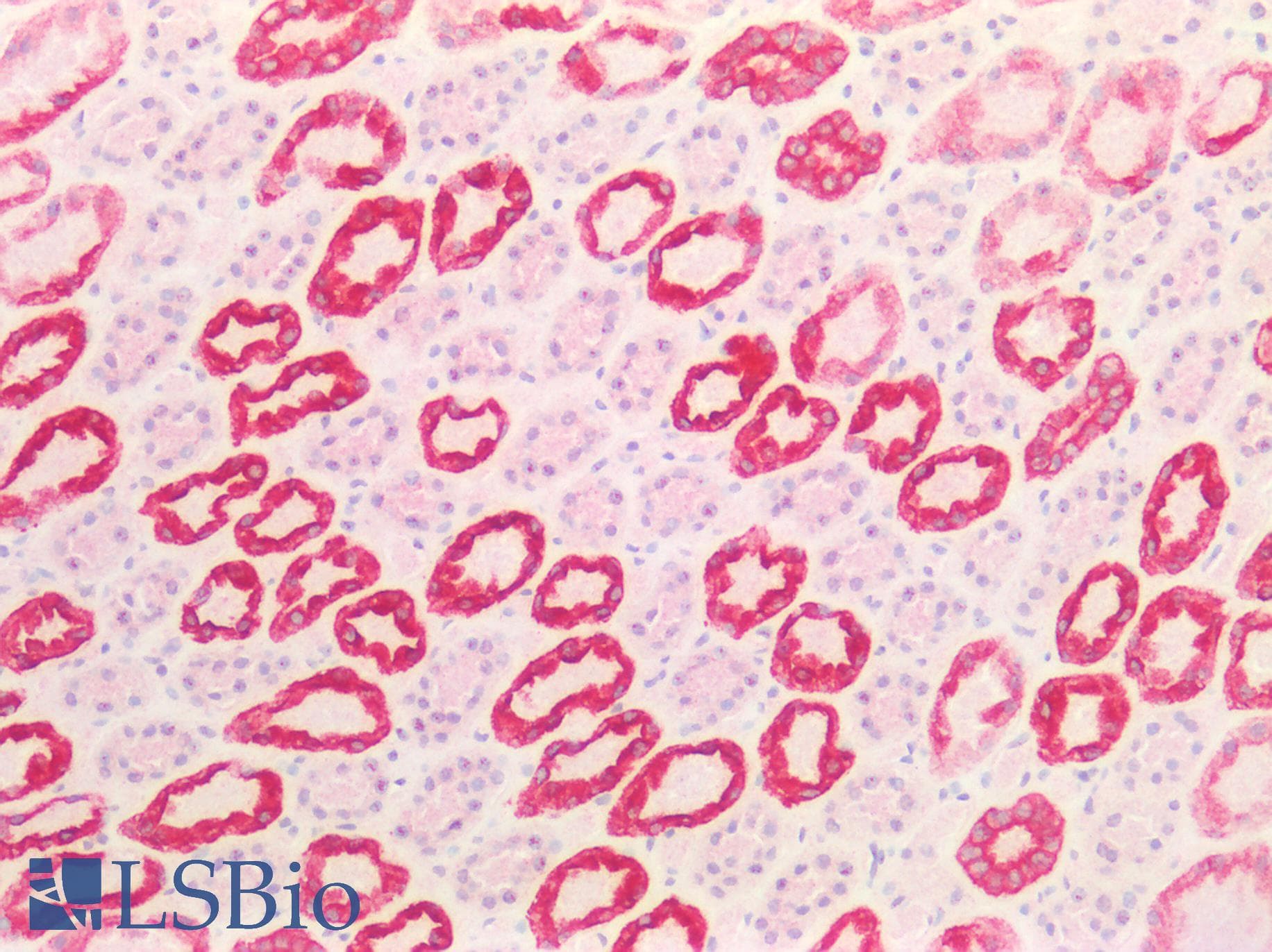 PathPlus™ KRT8 / CK8 / Cytokeratin 8 Antibody (aa25-74)