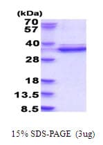 Human CDK2 Protein (Recombinant His)