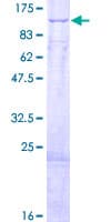 Human HADHA Protein (Recombinant GST)
