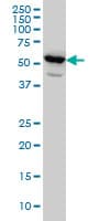 GATB / PET112 Antibody (clone 6B2)