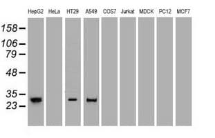 NOG / Noggin Antibody (clone OTI1H8)